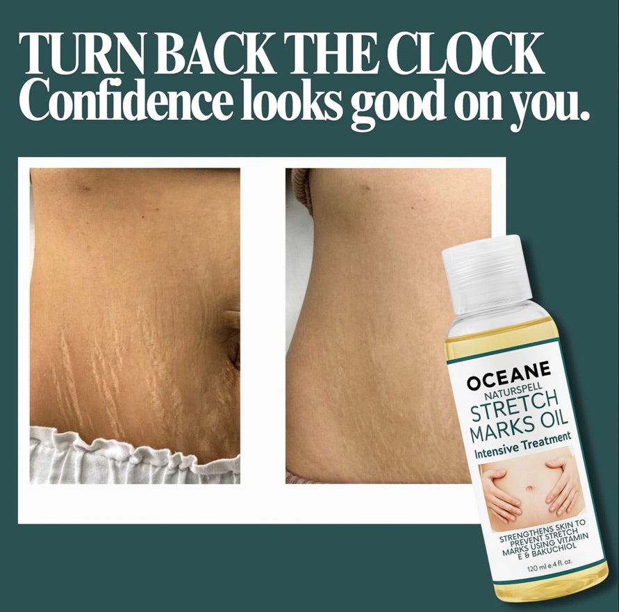 NaturSpell Stretch Mark Oil